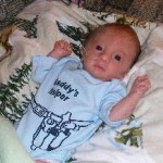 Baby Boy with Trisomy 18