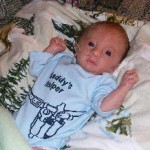 Baby Boy with Trisomy 18